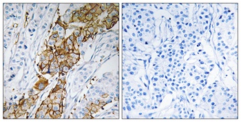 USP32 antibody