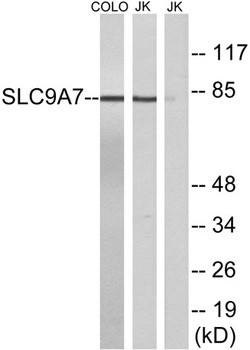 NHE-7 rabbit pAb Antibody