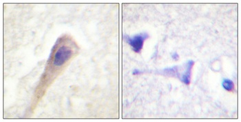 Catalase (phospho-Tyr386) antibody