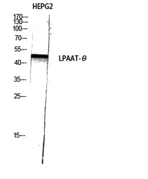 LPAAT-Theta antibody