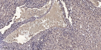 NFATc2IP antibody