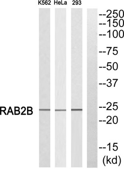 Rab 2B antibody