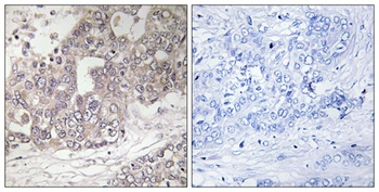 Atg4C rabbit pAb Antibody