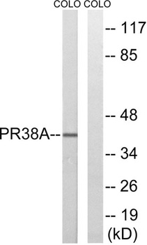 PRPF38A antibody