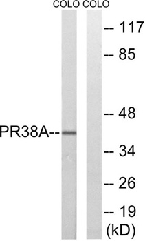 PRPF38A rabbit pAb