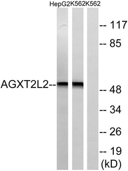 AGXT2L2 rabbit pAb