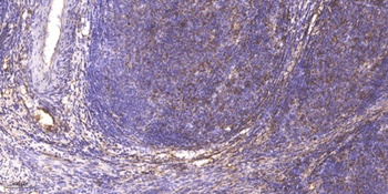 Mnk1 (phospho Thr255) rabbit pAb Antibody