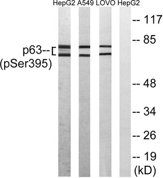 p63 (phospho-Ser395) antibody