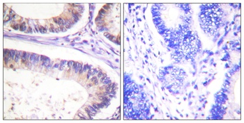 Cbl (phospho Tyr674) rabbit pAb