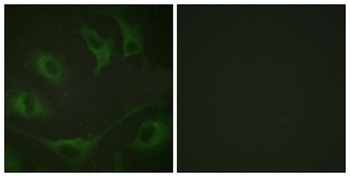 Cbl (phospho-Tyr774) antibody
