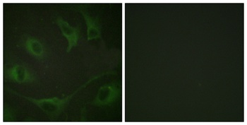 Cbl (phospho Tyr774) rabbit pAb