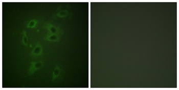 Cbl (phospho Tyr700) rabbit pAb Antibody