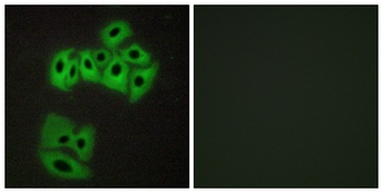 VAMP-4 rabbit pAb Antibody