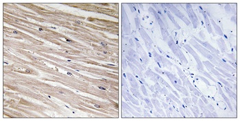 PEA-15 (phospho Ser104) rabbit pAb