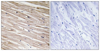 PEA-15 (phospho-Ser104) antibody