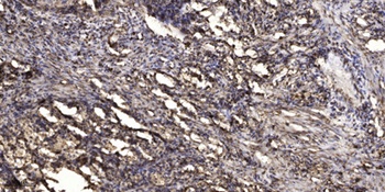 Keratin 37/38 rabbit pAb Antibody
