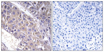 beta-1,4-Gal-T3 antibody