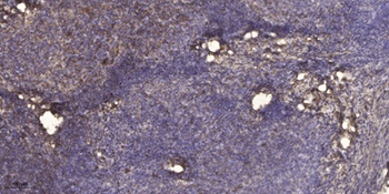 beta-1,4-Gal-T2 antibody