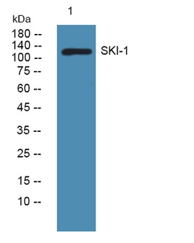 SKI-1 antibody