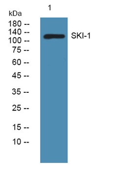 SKI-1 rabbit pAb