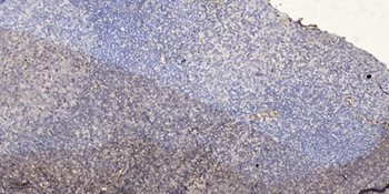 SNX3 rabbit pAb Antibody