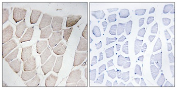 Myomesin-1 antibody