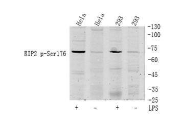 RIP2 (phospho-Ser176) antibody