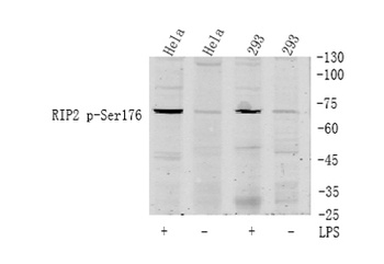 RIP2 (phospho Ser176) rabbit pAb
