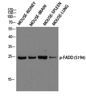 FADD (phospho-Ser194) antibody