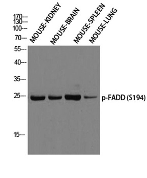 FADD (phospho Ser194) rabbit pAb
