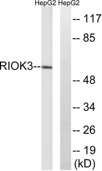 SUDD antibody