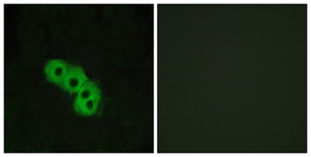 GPR109A antibody