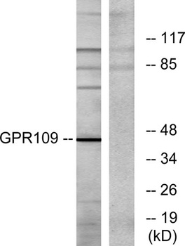 HM74 rabbit pAb Antibody