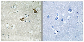 CCK-AR antibody