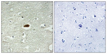 Per2 rabbit pAb Antibody