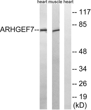 PIXbeta antibody