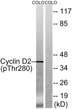 Cyclin D2 (phospho-Thr280) antibody