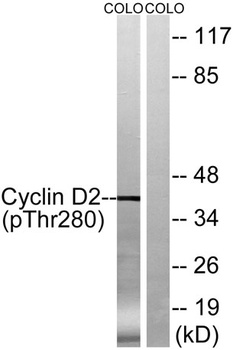 Cyclin D2 (phospho Thr280) rabbit pAb