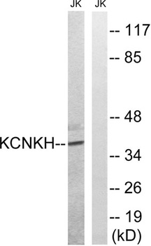 TALK-2 antibody