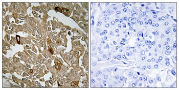 BTBD6 antibody