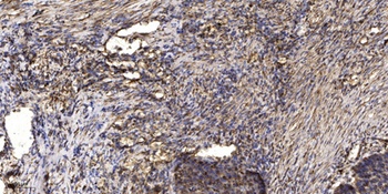 Dok-2 (phospho Tyr345) rabbit pAb