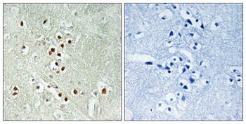 CRIF1 rabbit pAb