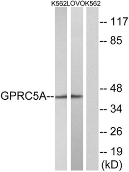 RAI3 antibody