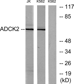 ADCK2 rabbit pAb