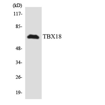 TBX18 rabbit pAb Antibody