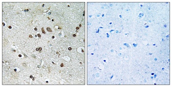 BTF3L4 antibody