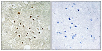 Ribosomal Protein S19BP rabbit pAb