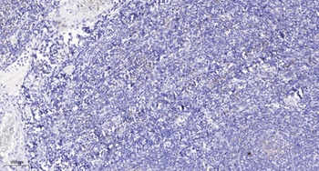RASL10B rabbit pAb Antibody