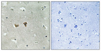 Lfc (phospho-Ser885) antibody