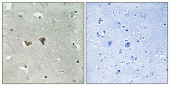 Lfc (phospho Ser886) rabbit pAb